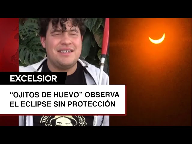 ¿Milagro? Ojitos de Huevo presumió que 'vio' eclipse solar sin protección