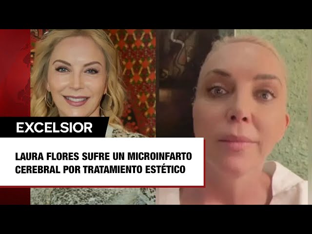 Laura Flores sufre un microinfarto cerebral por tratamiento estético