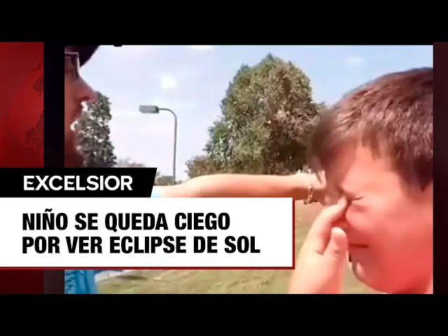 Niño se queda ciego por ver eclipse de Sol