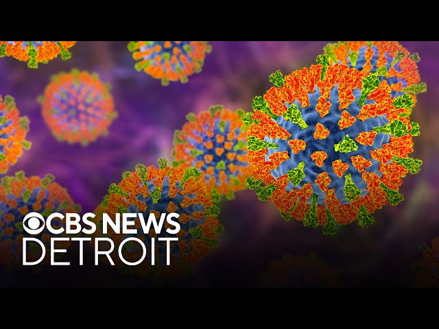 Measles confirmed in Detroit child, unsafe levels of lead in Lunchables and more top stories