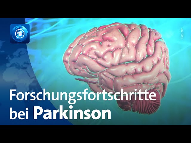 ⁣Welt-Parkinson-Tag: Was sich in der Forschung tut