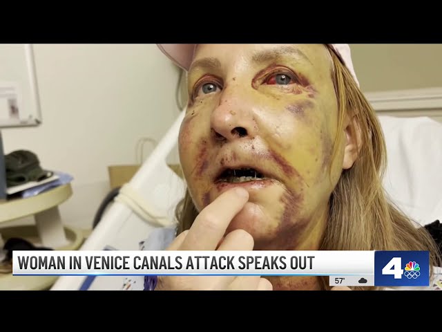 Woman attacked near Venice Canals shares story