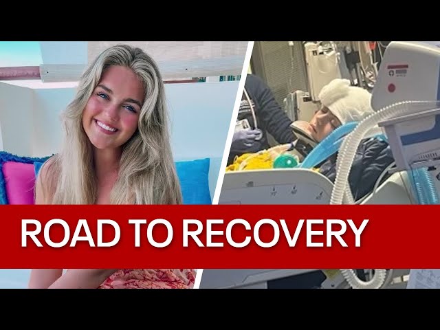 ⁣Dallas woman beating the odds as she recovers from hit-and-run crash that killed roommate
