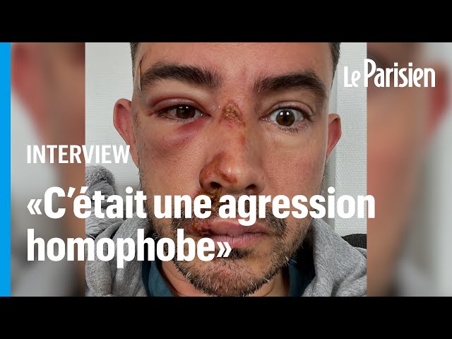 ⁣Lyon : Quentin raconte son agression à la sortie d'un bar LGBT