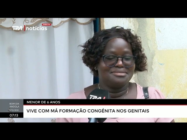 Menor de 6 anos vive com má formação congénita nos genitais