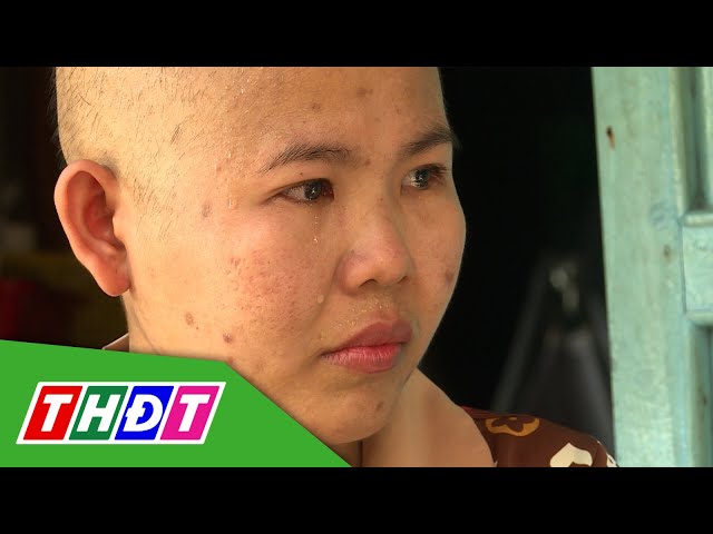 Hoàn cảnh chị Bùi Ngọc Lan (huyện Hồng Ngự) | Nhịp cầu nhân ái - 16/4/2024 | THDT