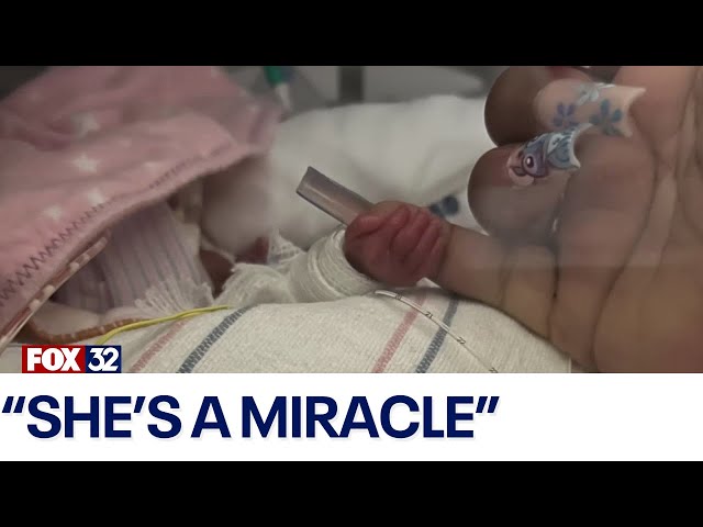 ⁣'Miracle' preemie gets to go home