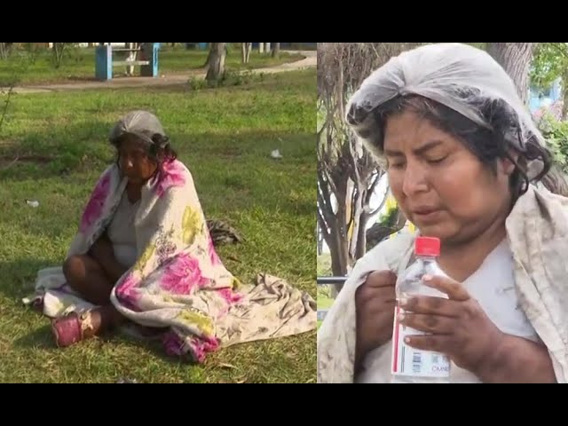 ⁣Ate: Vecinos piden ayuda para mujer indigente con pie gangrenado