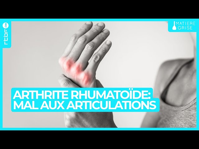 Arthrite rhumatoïde : avoir mal aux articulations n'est pas qu'une question d'âge - M