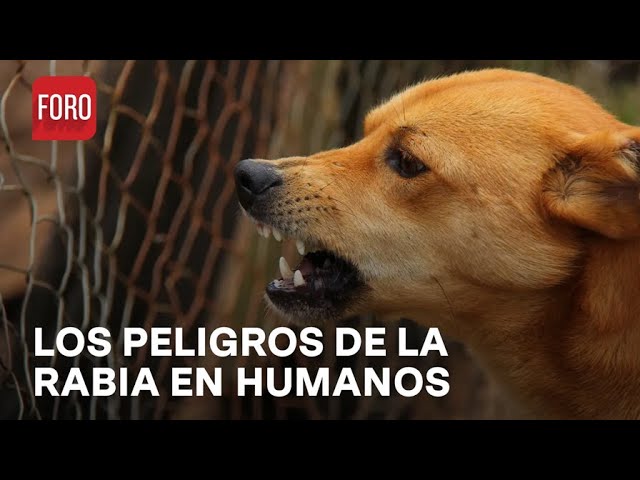 Detectan segundo caso de rabia humana en México - Las Noticias