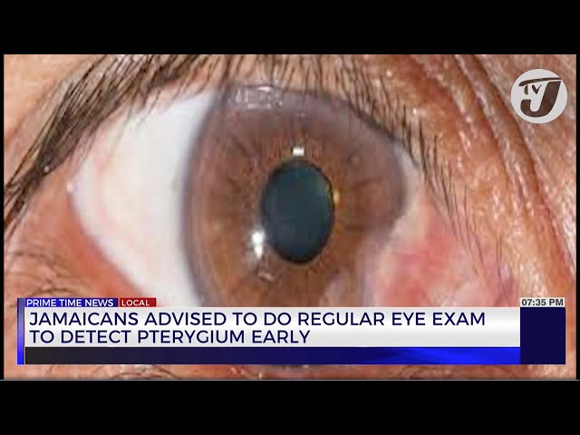Jamaica Advised to Do Regular Eye Exams to Detect Pterygim Early