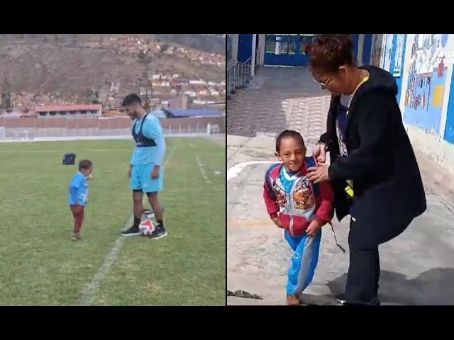 ⁣Tarma: Niño es amante del fútbol y pide una pierna ortopédica para poder jugar