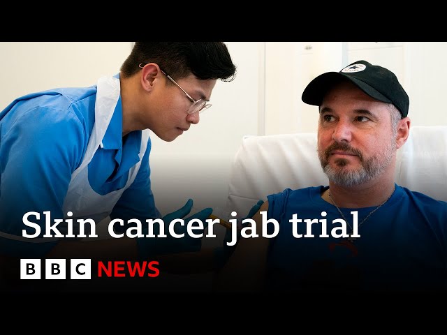 ⁣First ‘personalised’ melanoma skin cancer vaccine trial under way in UK | BBC News