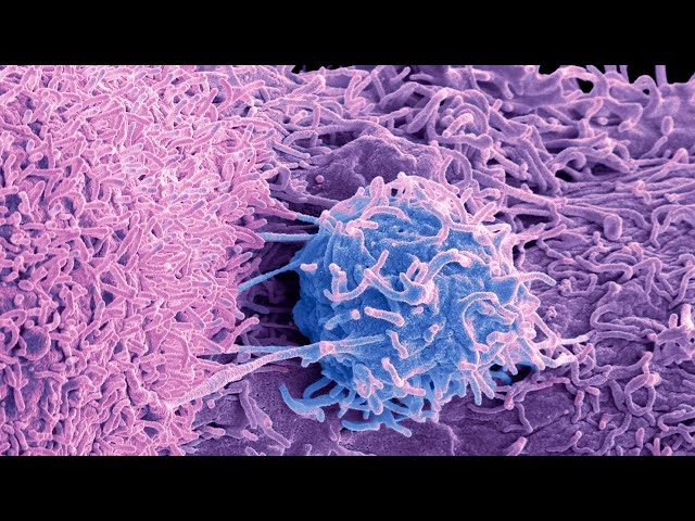 Push to increase prostate cancer testing