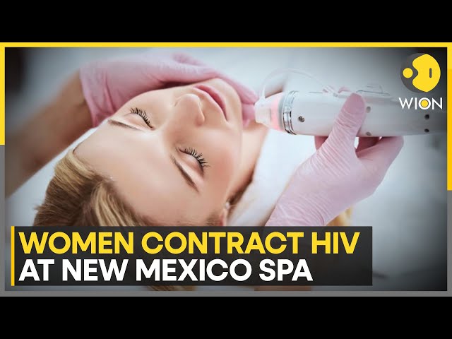 ⁣3 women contract HIV after getting ‘vampire facial’ at New Mexico spa | WION News