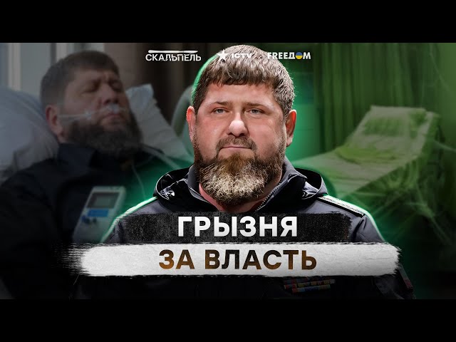 ⁣Палач Чечни ум*рает  КТО станет НОВЫМ верным шакалом Путина
