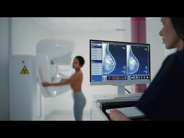 ⁣Why US experts are now recommending breast cancer screenings for women in their 40s