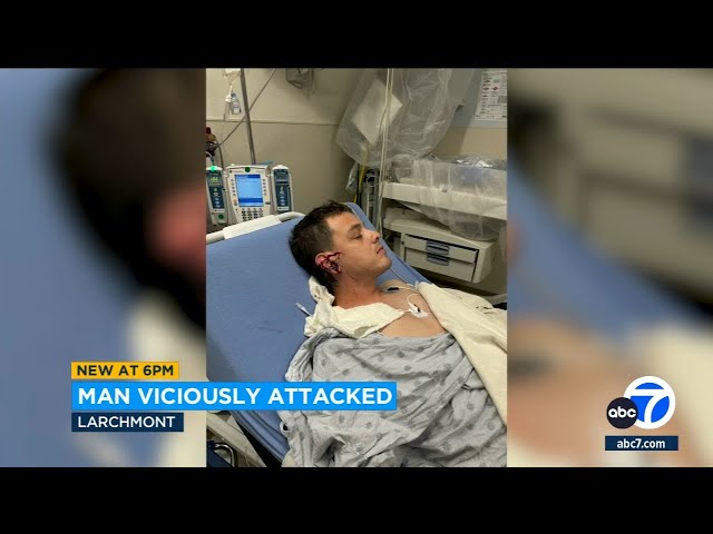 ⁣Larchmont man's ear sliced off in violent attack outside his home
