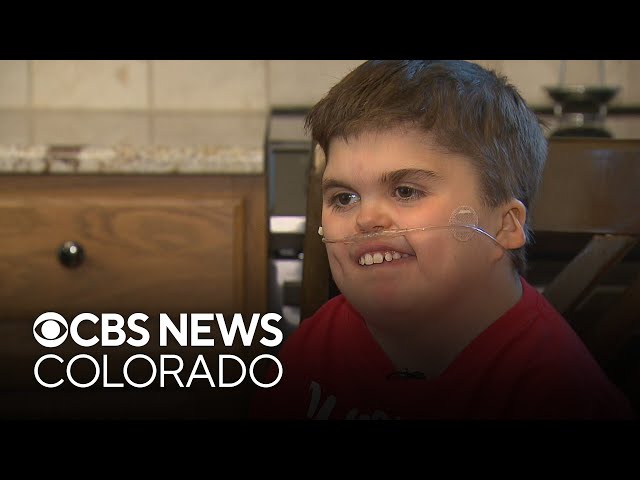 ⁣Boy born with rare genetic condition lives every day to fullest as patient ambassador