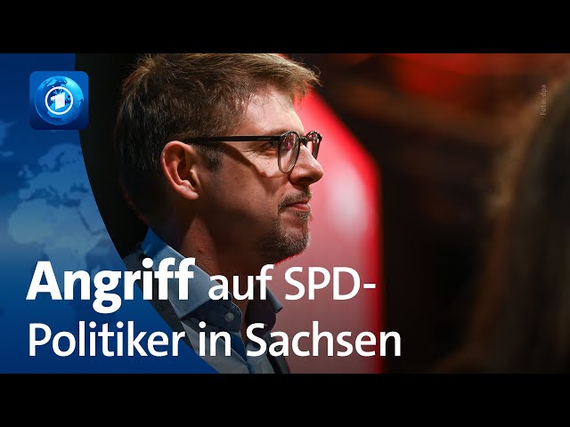 ⁣SPD-Politiker Ecke bei Angriff in Dresden schwer verletzt