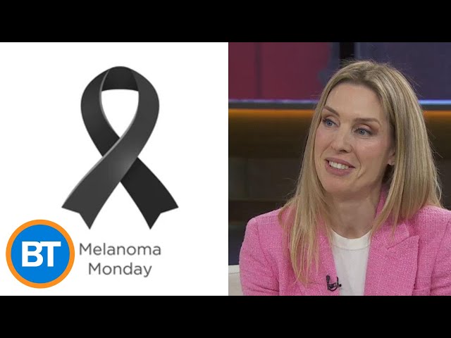 ⁣The best ways to prevent Melanoma — and how to detect early signs