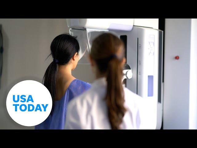 ⁣Here's what we know now about new guidance issued on breast cancer screenings | USA TODAY