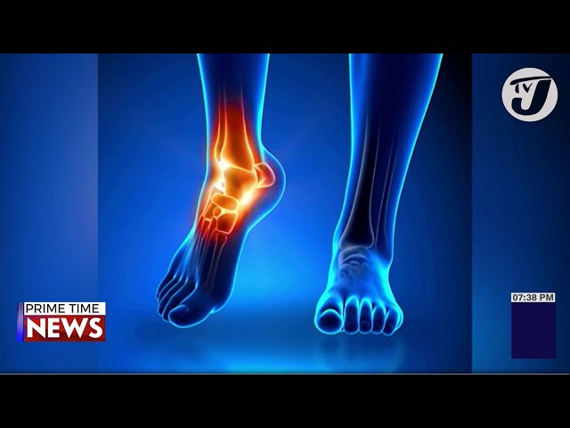 Overuse Injuries: Early Diagnosis is Crucial with Dr. Michael Harvey | TVJ News