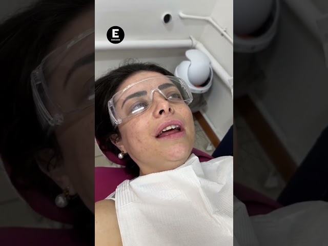 ⁣Violeta Isfel sorprende tras quitarse las carillas y mostrar sus dientes reales