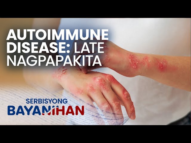 Ano ang autoimmune disease?