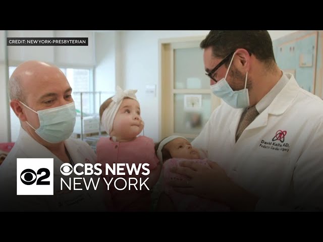 ⁣Families mark anniversary of life-saving pediatric domino heart transplant