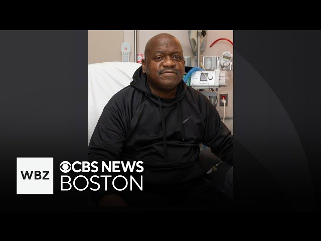 ⁣Massachusetts man who received first-ever pig kidney transplant dies two months after surgery