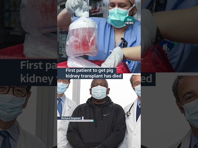 ⁣First patient to get pig kidney transplant has died #itvnews