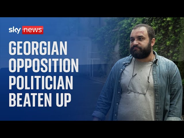 ⁣Georgian opposition politician says he was targeted by 'Putin's puppets'