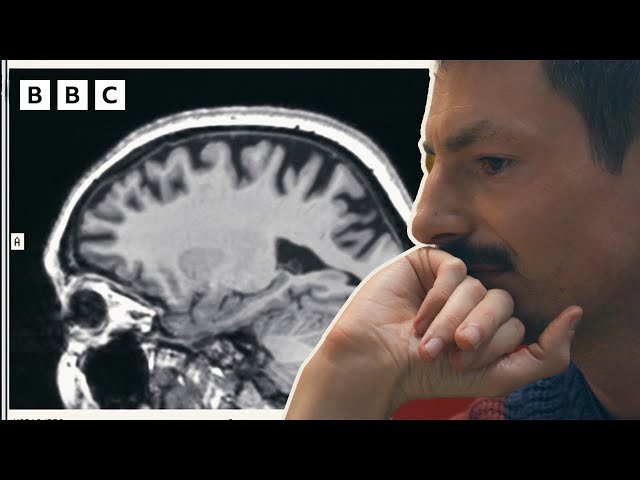 ⁣Son's sees how Alzheimer's affected his mum's brain across the years | The Jennings v