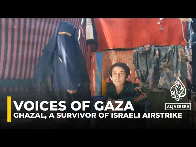 ⁣Survivor of Israeli airstrike faces long road to recovery