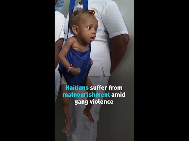 ⁣Haitians suffer from malnourishment amid gang violence