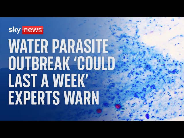 ⁣Water parasite outbreak 'could last a week' expert warns