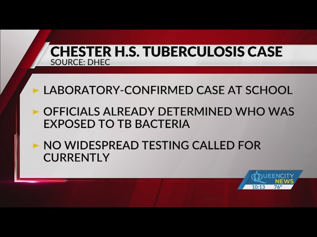 ⁣Tuberculosis case confirmed at Chester High School: DHEC