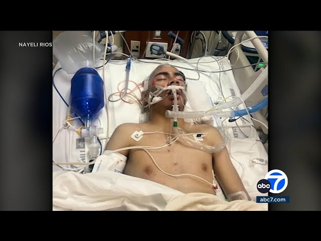 ⁣15-year-old fighting for his life after brutal beating outside restaurant in Watts
