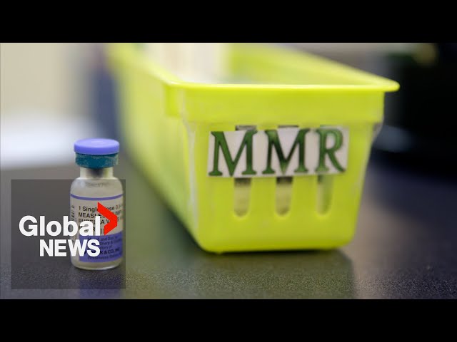 ⁣Unvaccinated Ontario child dies of measles, sparks concern among health community