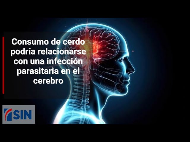 ⁣Consumo de cerdo podría relacionarse con una infección parasitaria en el cerebro