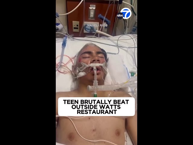 ⁣15-year-old in ICU after brutal beating outside Watts restaurant
