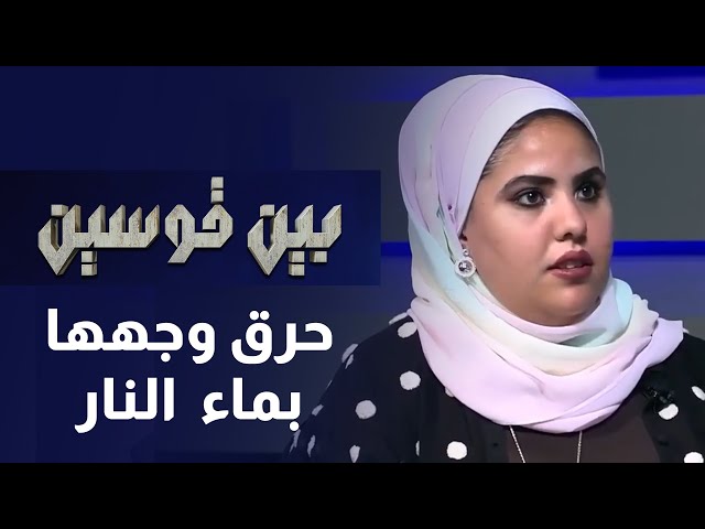 ⁣فاجعة غريبة من نوعها سكب ماء النار على وجهها !  بين قوسين