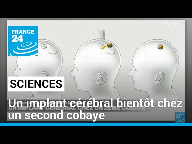 ⁣Neuralink : un implant cérébral bientôt chez un second cobaye • FRANCE 24