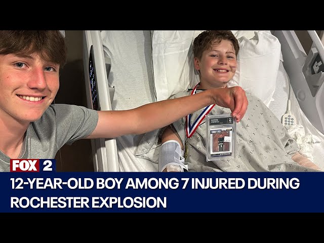 ⁣Family of child injured during Rochester explosion speak up