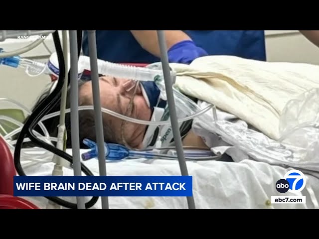 ⁣Assault at Boyle Heights McDonald's leaves woman brain dead