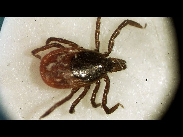 ⁣CANADA'S TICK PROBLEM | Experts warn of health risks during summer population surge