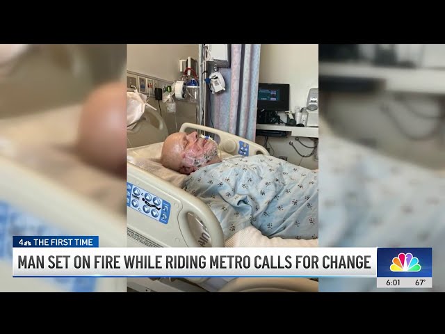 ⁣Los Angeles Man recalls being set on fire while riding Metro train