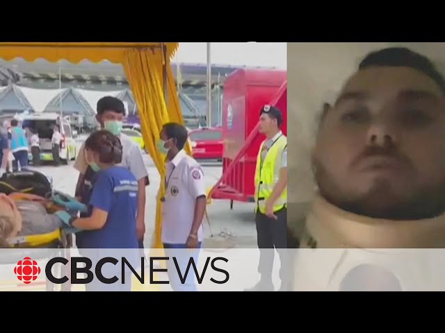⁣Severe turbulence, emergency landing were 'surreal,' injured Singapore Airlines passenger 