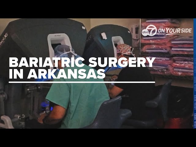 ⁣Robotic bariatric surgery shows promising patient outcomes